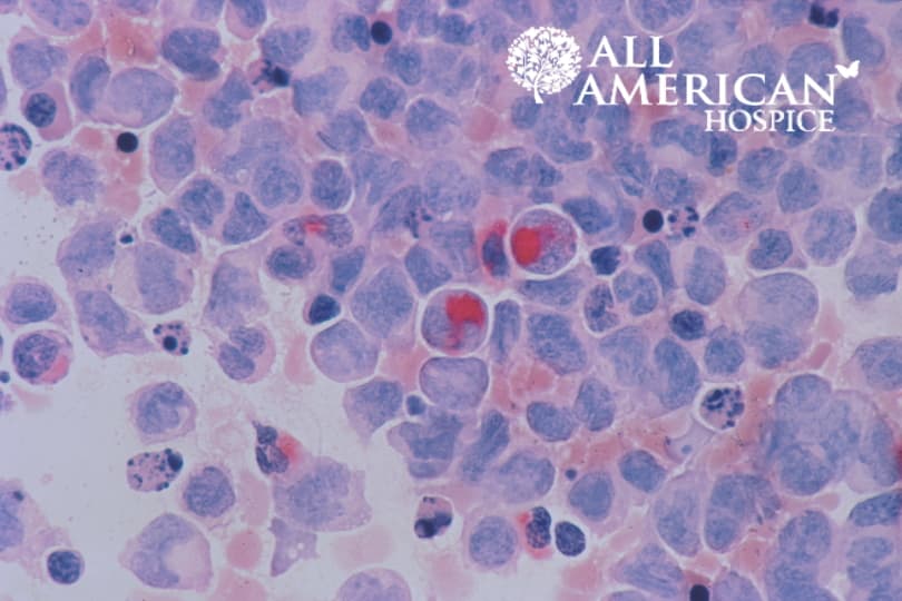 leukemia symptoms skin